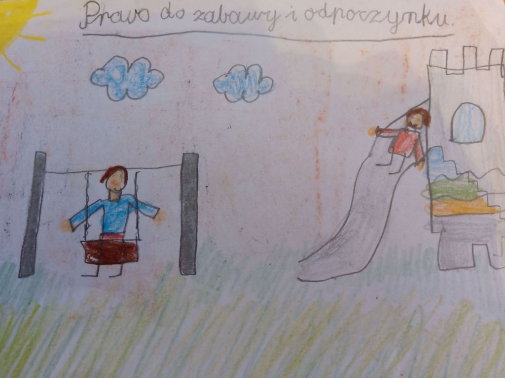 3 Albina (2)